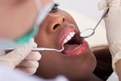 Women & Gum Health: bleeding gums treatment in Fallston, Maryland