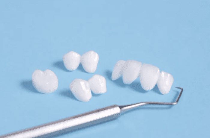 dental veneers sitting on a blue background with dental scaler dentist in Fallston Maryland 