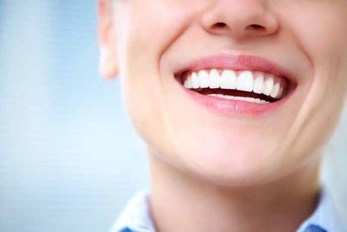 PORCELAIN VENEERS in FALLSTON MD may be more affordable than you think